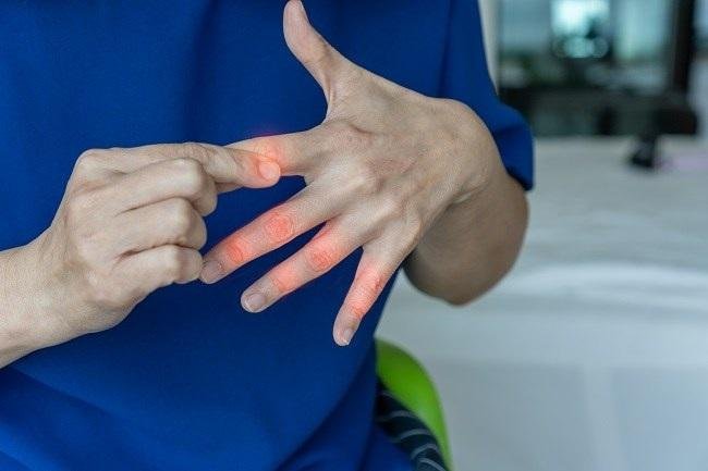 Sering Kesemutan? Ini Cara Menghilangkan Jika Terjadi di Tangan Kanan