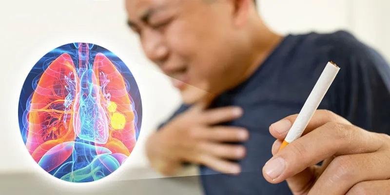 Tekan Kanker Paru, Masyarakat Bisa Akses Layanan Berhenti Merokok ke 21 Puskesmas di Pekanbaru